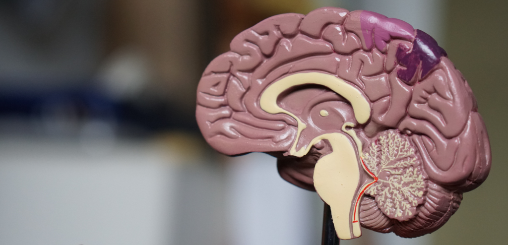 Corea de Huntington: fisiopatología, síntomas y tratamiento